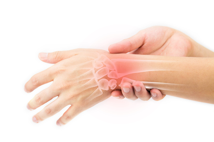 prevenir la artritis